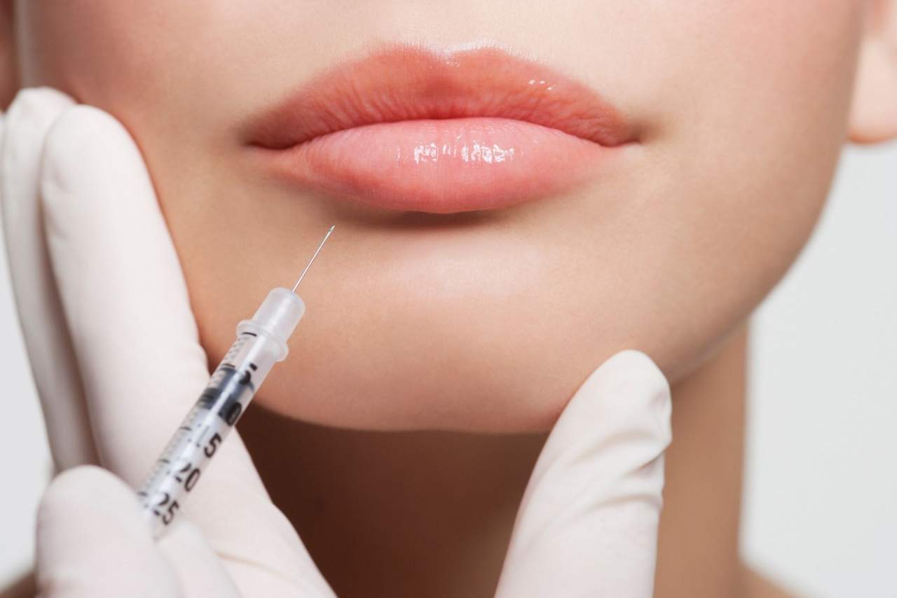 Precauciones después del botox según la Dra. Alfonsina Uriburu