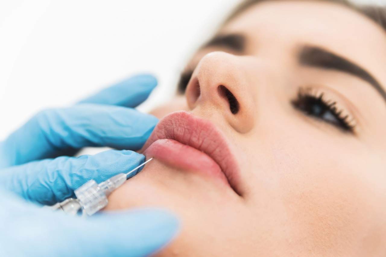 ¿Dónde realizarse aumento de labios con ácido hialurónico en Castellón? Clínica Sánchez Peral