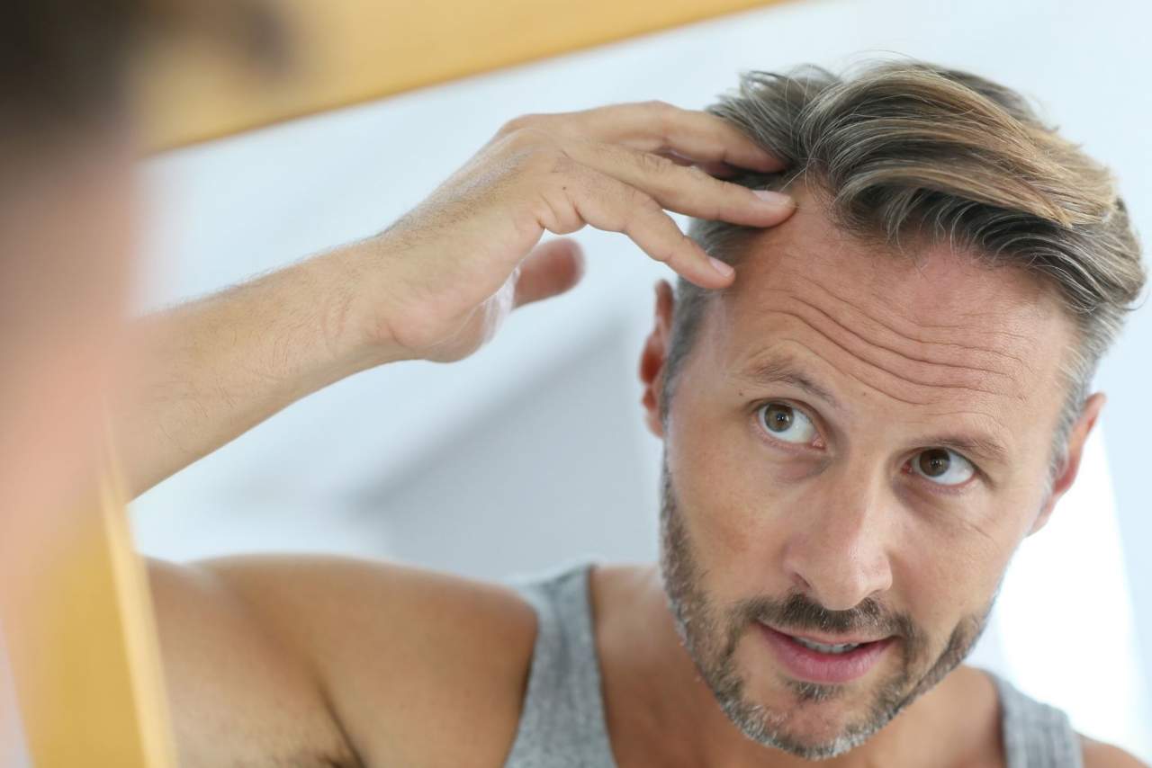 My Special Hair: ¿Son las prótesis capilares a medida el futuro?