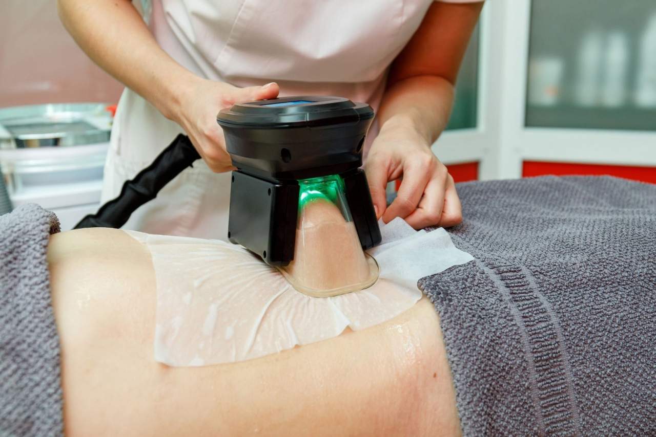 Criolipolisis médica: Eliminar grasa localizada en Santiago de Compostela con la Dra. Alfonsina Uriburu