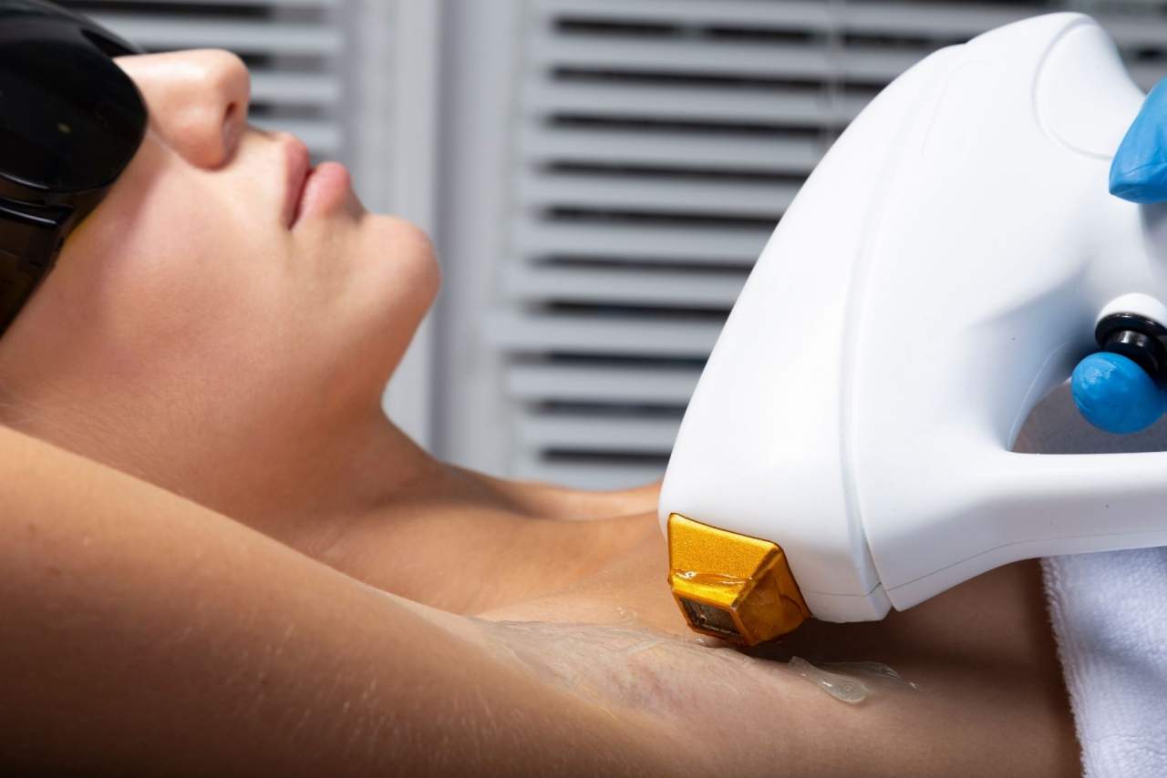 Depilación láser en Elche en centro de belleza y estética Ada Beauty