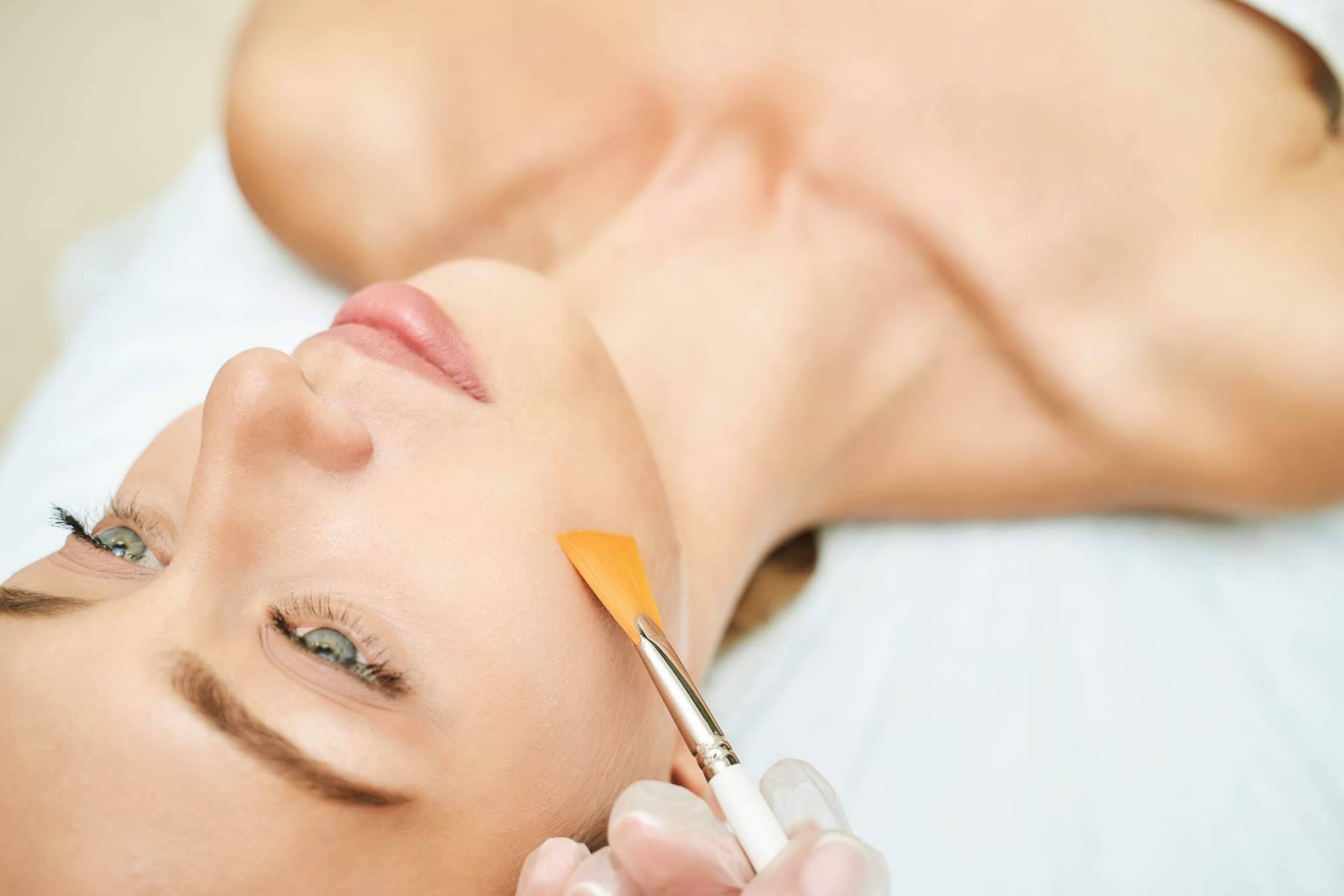 Peeling médico, el tratamiento de Unidad Femme que logra mejorar la salud y el aspecto de la piel