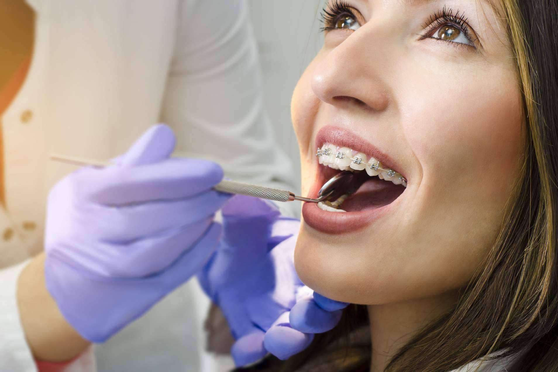 Helident Clínica Dental ofrece tratamiento de ortodoncia con brackets