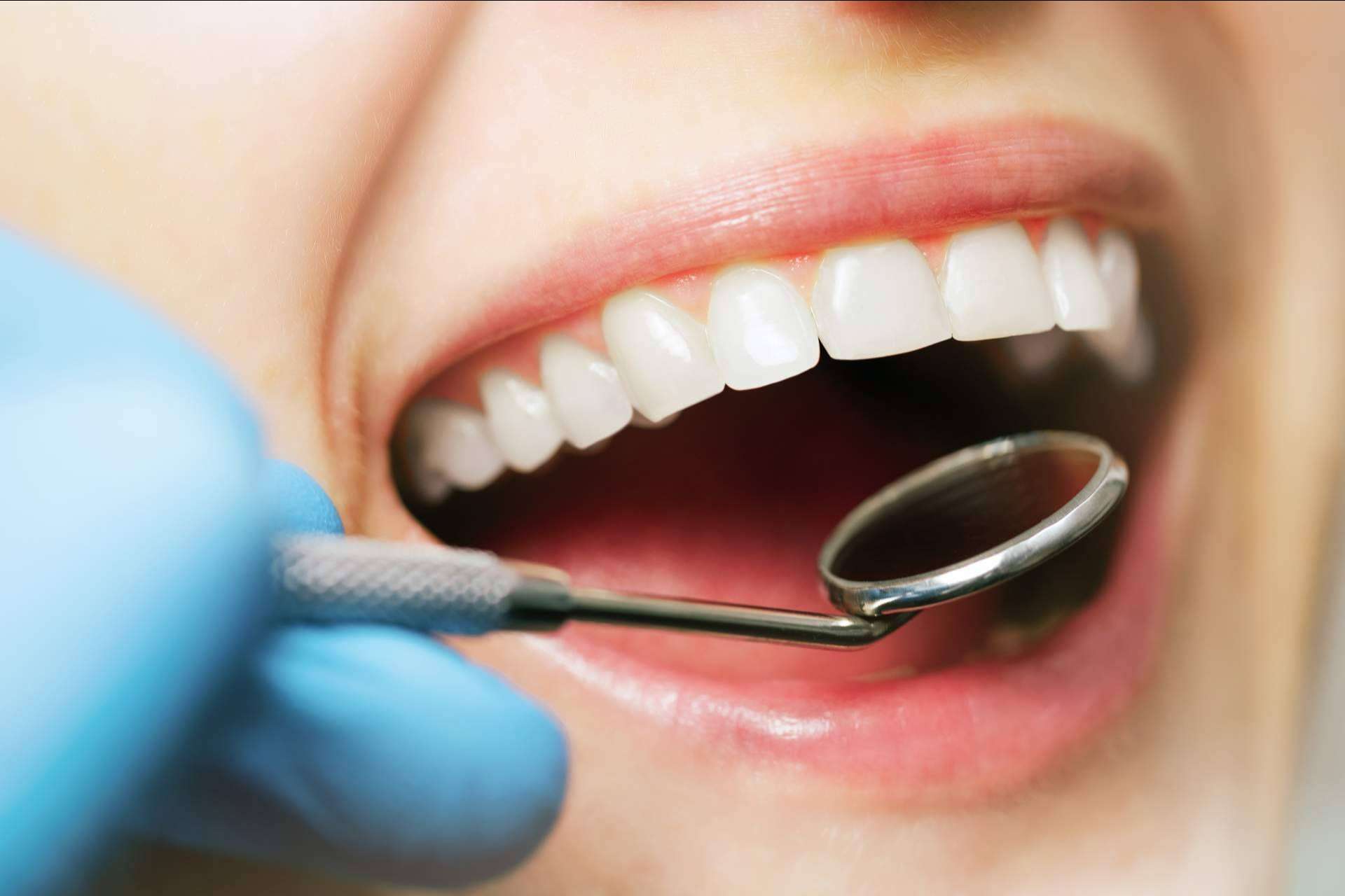 Profesionalidad y tecnología en odontología estética en Sevilla de la mano de Clínicas Dental Bell