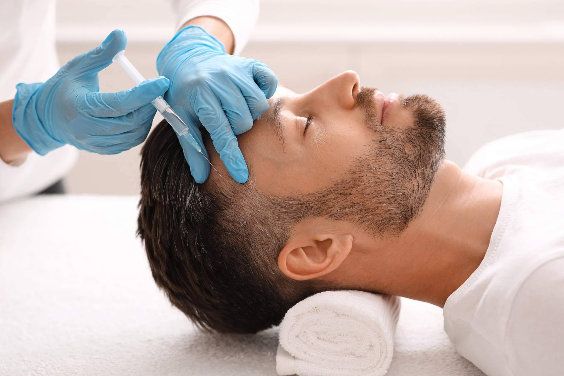 Los beneficios de la mesoterapia capilar de la mano del Dr. Bruno Jacobovski