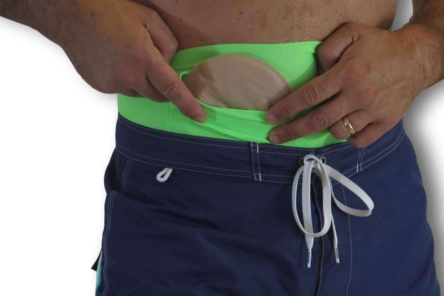 Las fajas para bañarse en la piscina con una ostomía, por Maldita Hernia