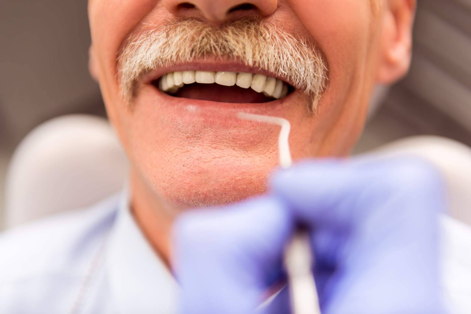 La clínica Corrales Dental es especialista en colocar implantes cigomáticos