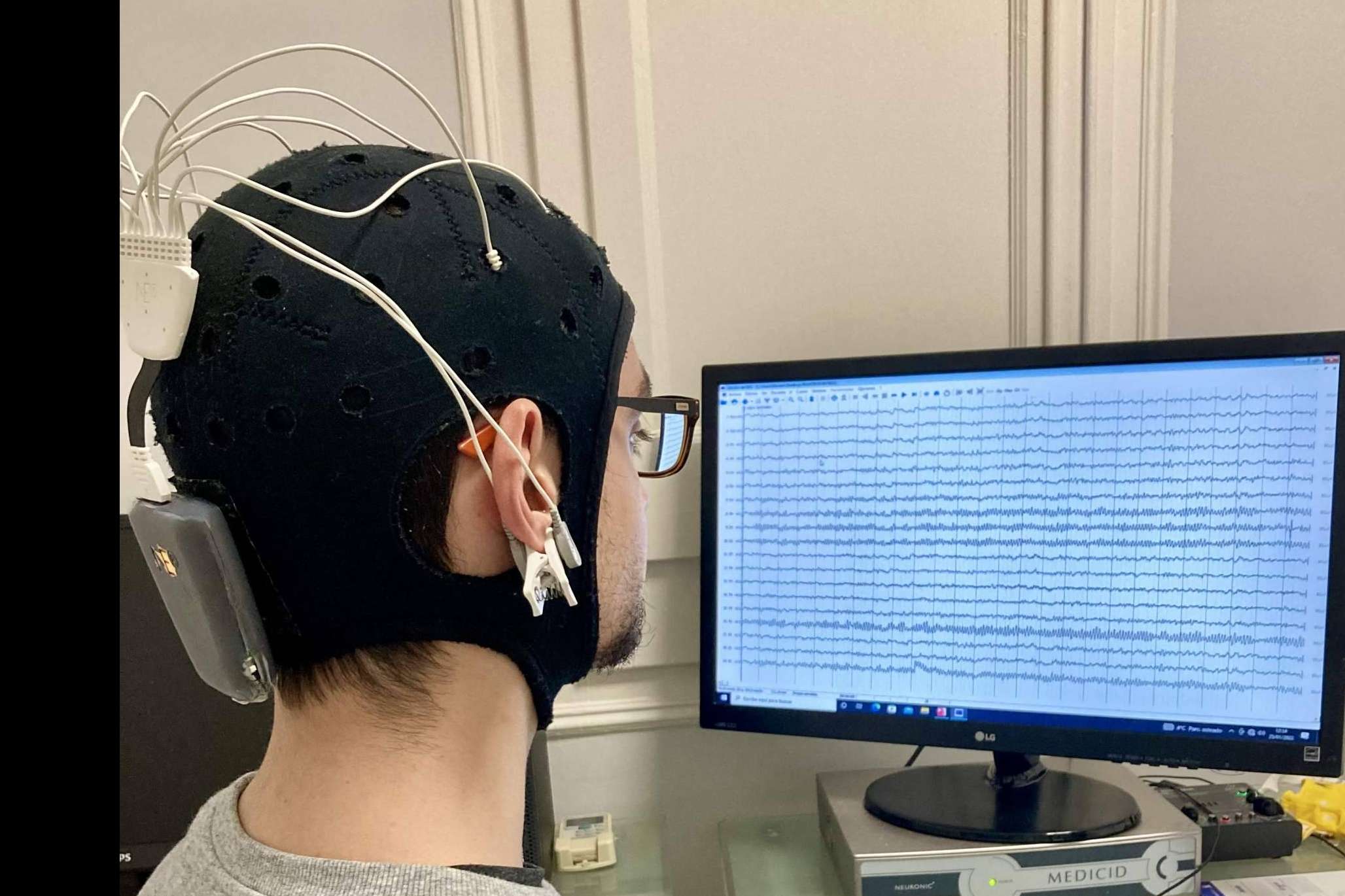 Los tratamientos de neuromodulación aceleran la recuperación tras sufrir un ictus