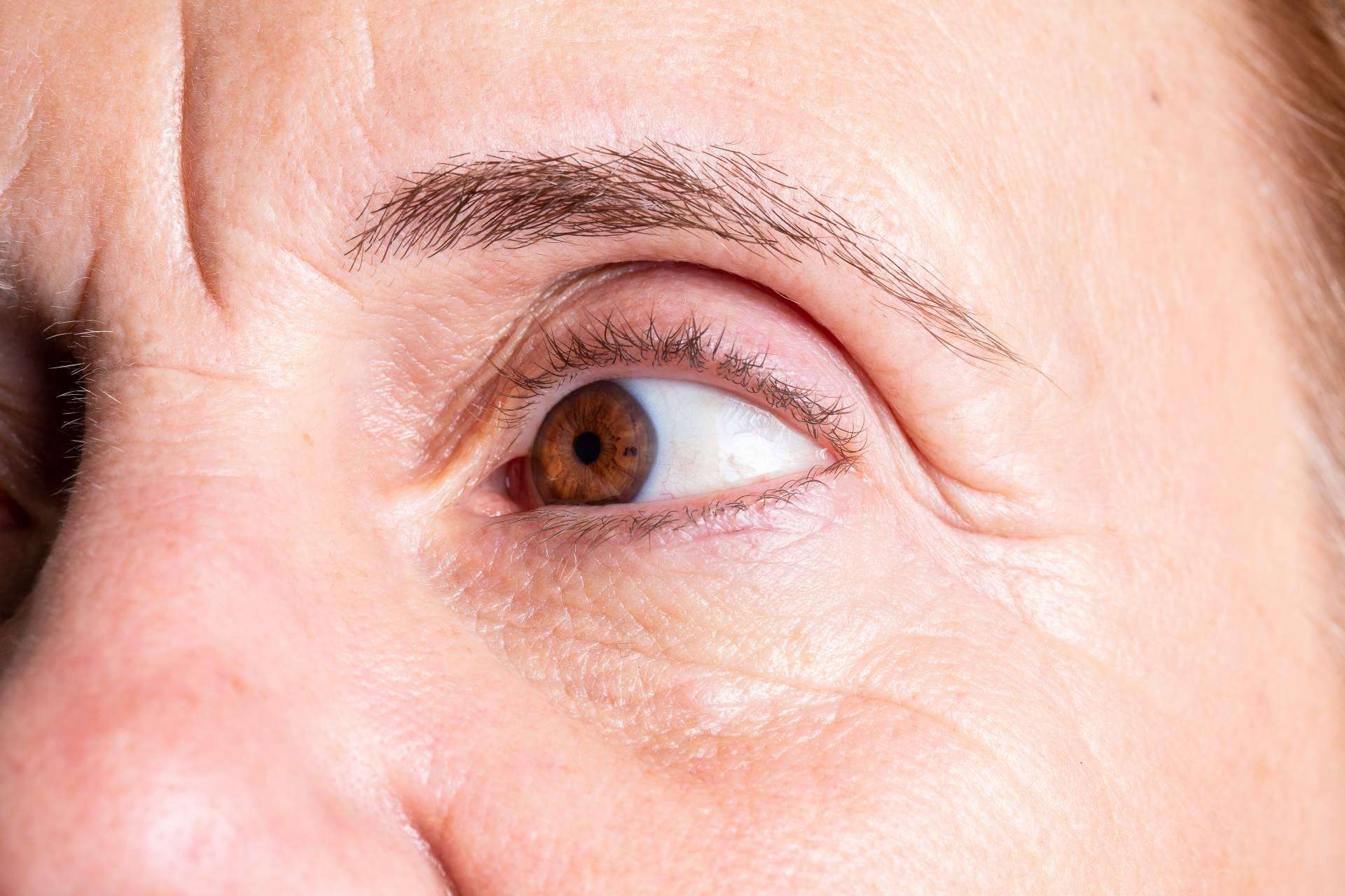 Dr. Carlos Zito es especialista en medicina estética de tratamientos de ojeras