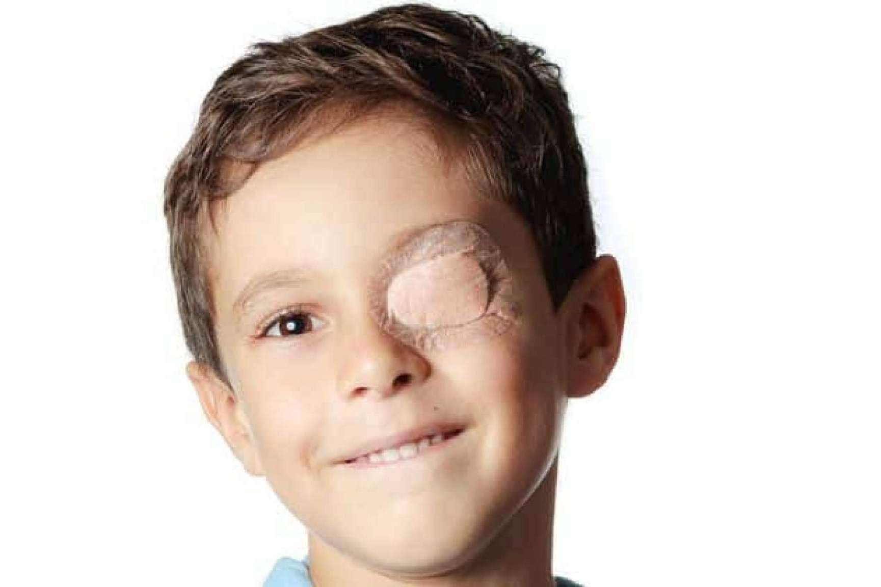 ¿Cómo curar el ojo vago? Los nuevos tratamientos, de la mano de Dicopt