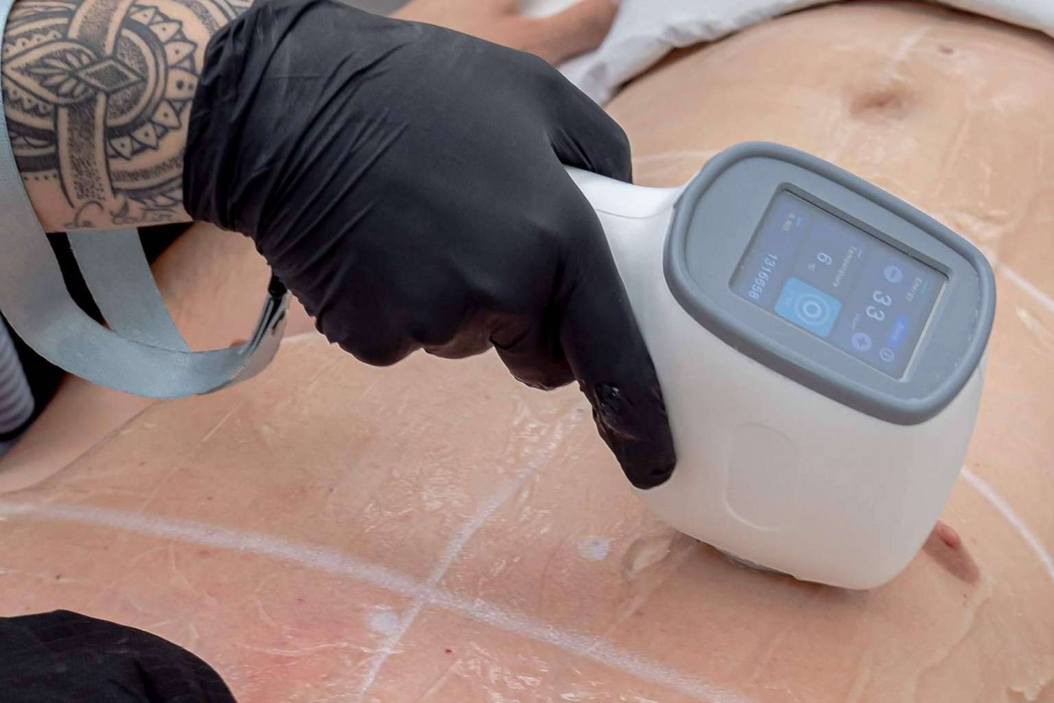 ¿De qué depende la eficacia en la depilación laser?, por Sapphira Privé