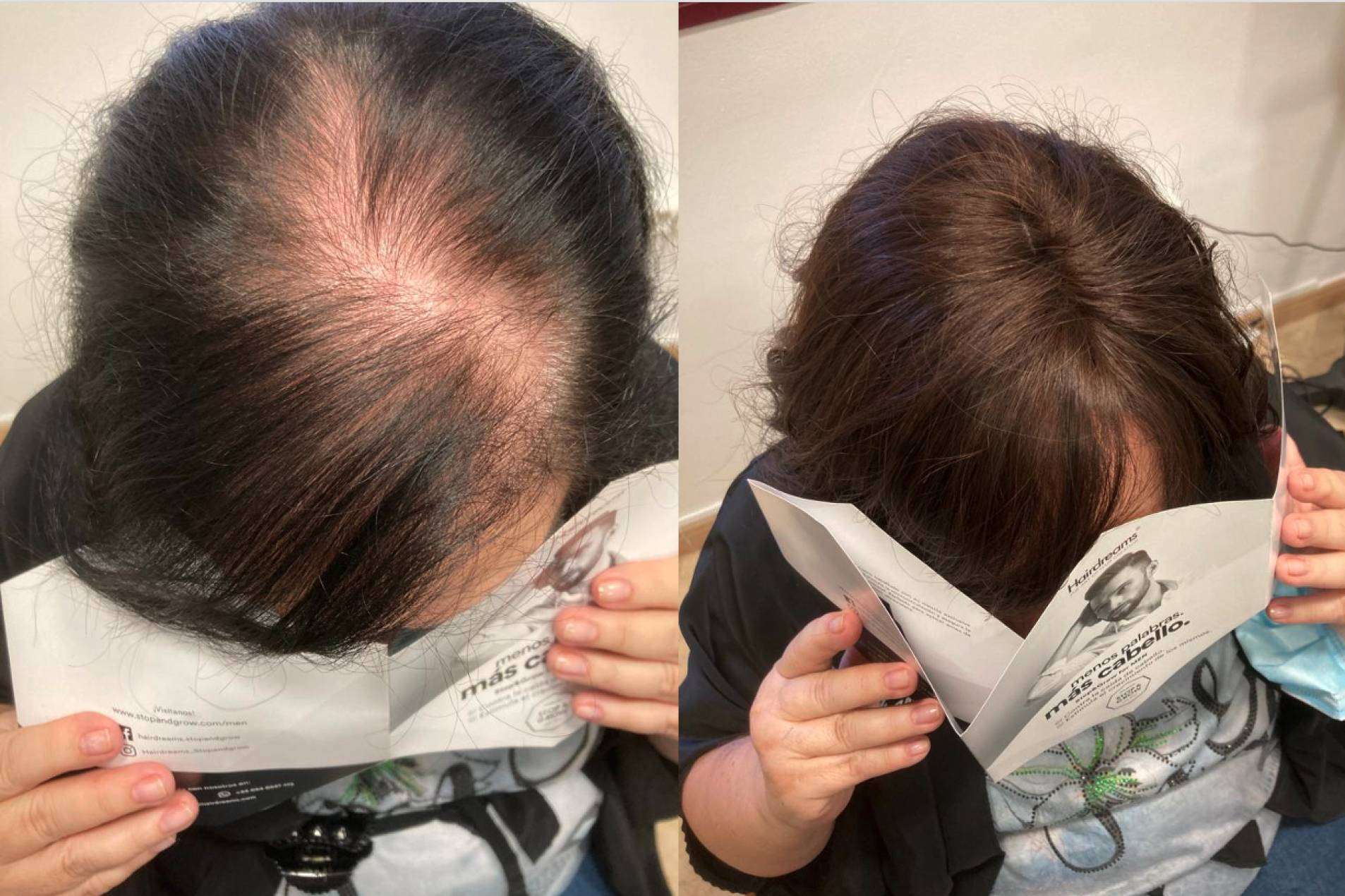Mar Chancosa y las extensiones de cabello 100% de cabello natural de Hairdreams