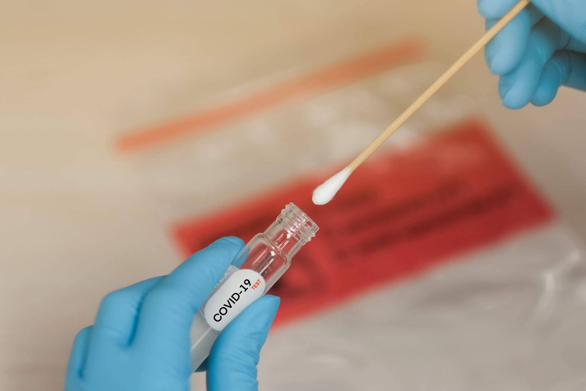 La importancia de haber utilizado el test covid para las fiestas, de la mano de Centro Médico Bravo