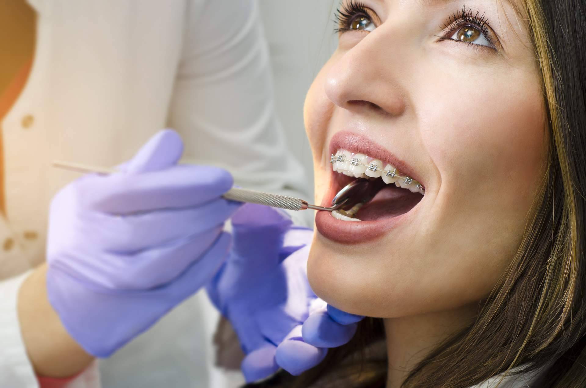 ¿Por qué es importante acudir a centros expertos en ortodoncia como la Clínica Dental Delgado?