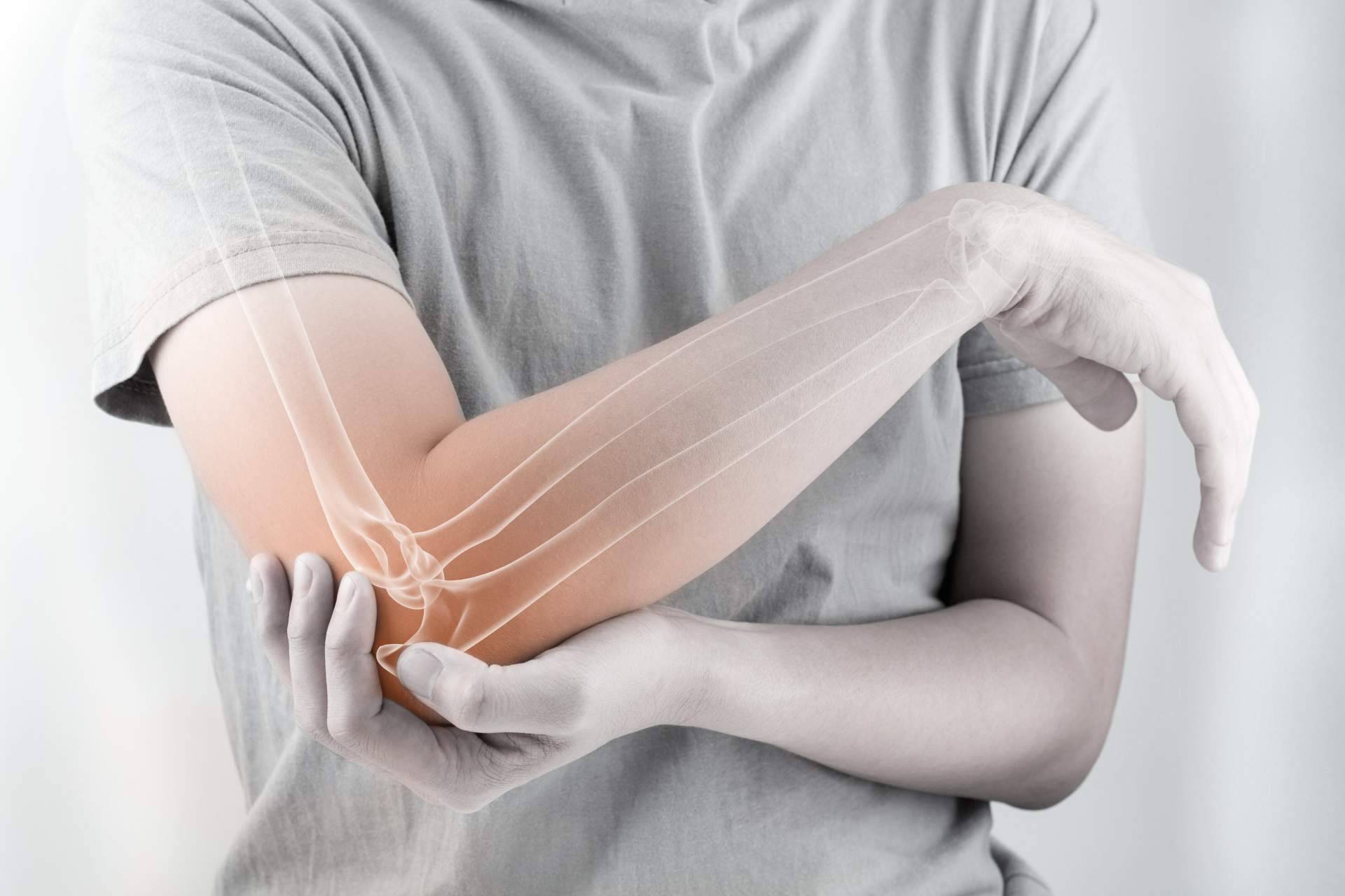 La línea de productos disponibles en Bibefy para combatir el dolor articular