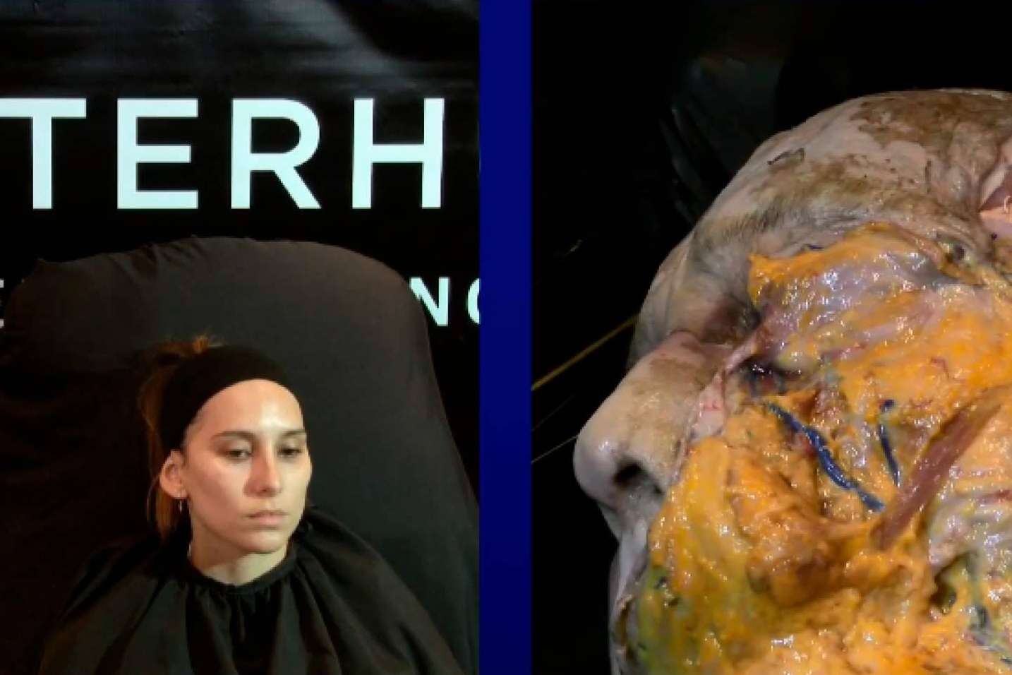 El congreso de medicina estética, Masterhub