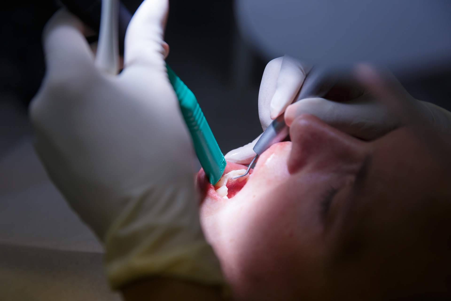 ¿Cómo tratar la enfermedad de las encías?, por Clínica Dental Agudo Rosa