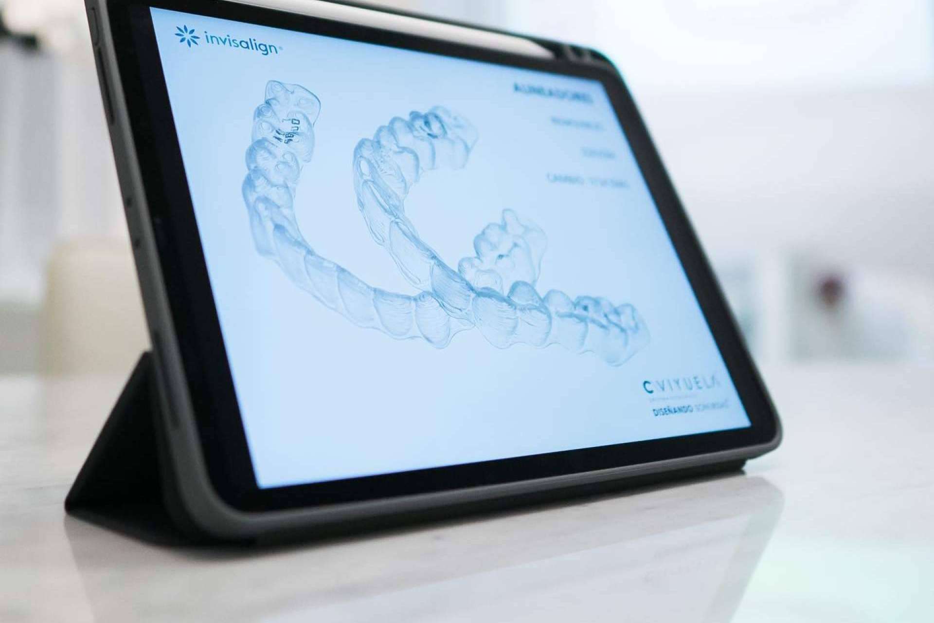 Doctora Viyuela explica qué diferencia a un ortodoncista de otro en la ortodoncia invisible con la técnica Invisalign