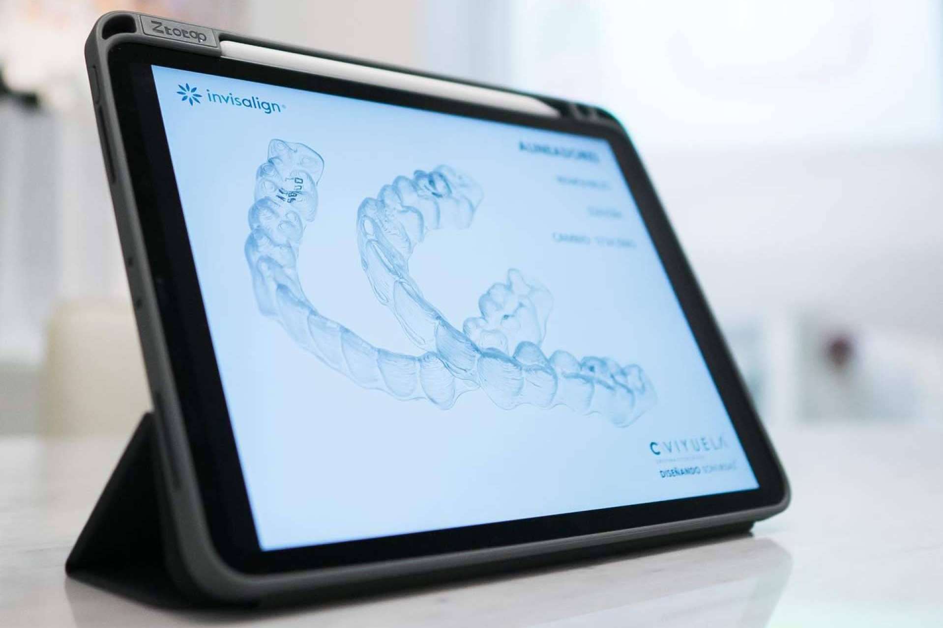 ¿Cuál es el precio de Invisalign? Toda la información sobre los precios de la ortodoncia invisible más conocida