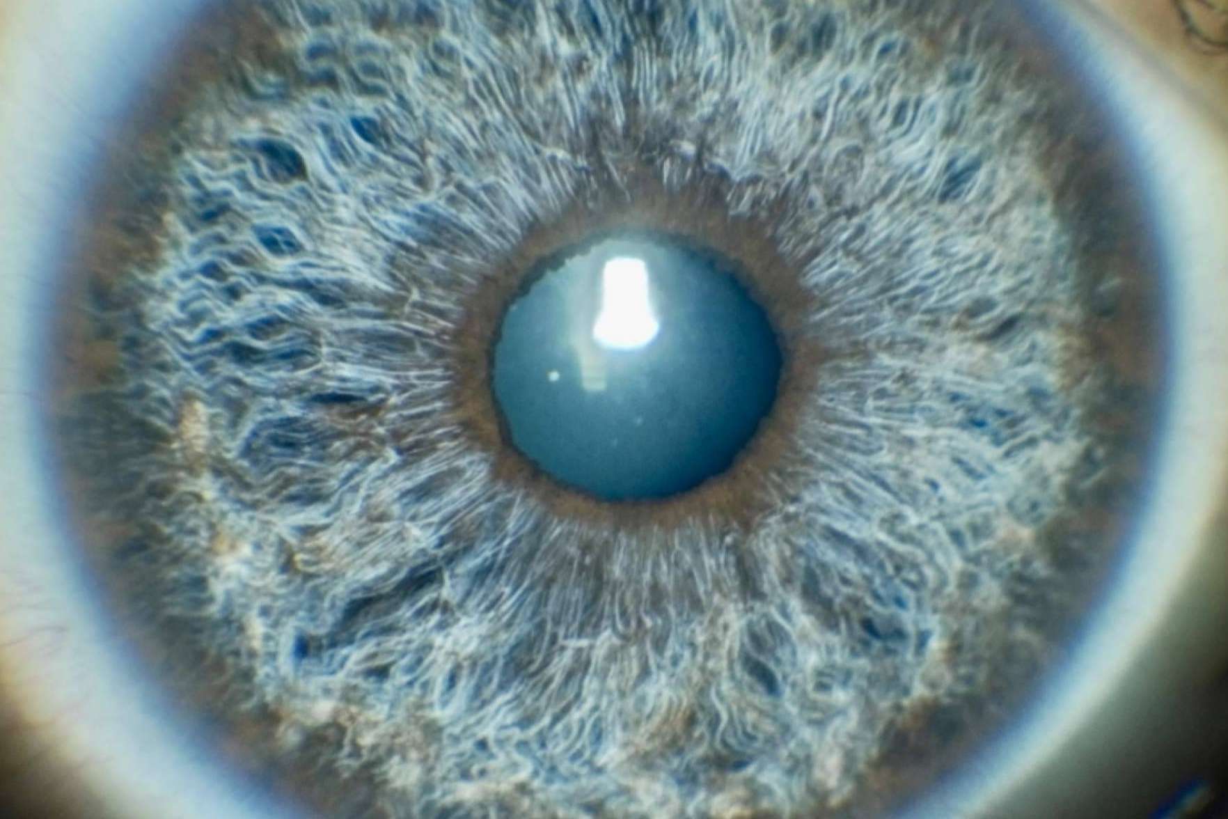 Eyecos, la clínica que puede predecir y simular en 3D el resultado del cambio de color de ojos con láser