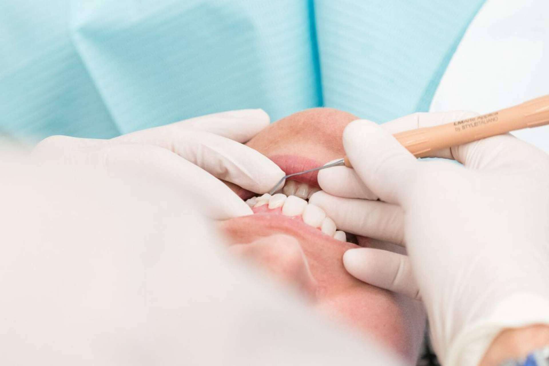 ¿Qué es la GUNA?, por la Clínica Dental en Madrid Ruiz de Gopegui