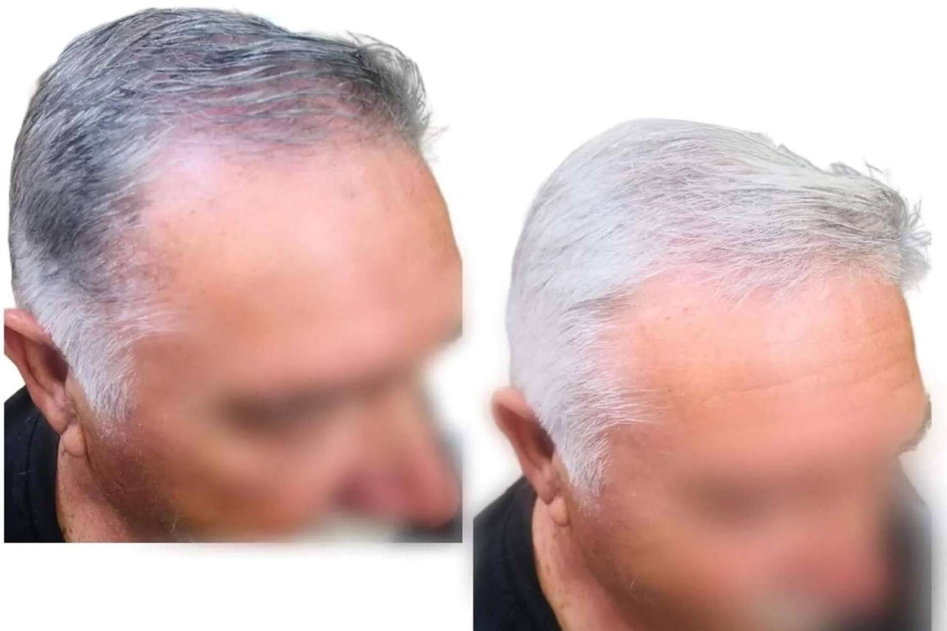 Cera Negra Anti-Canas de fijación perfecta; la revolución en el cuidado capilar masculino