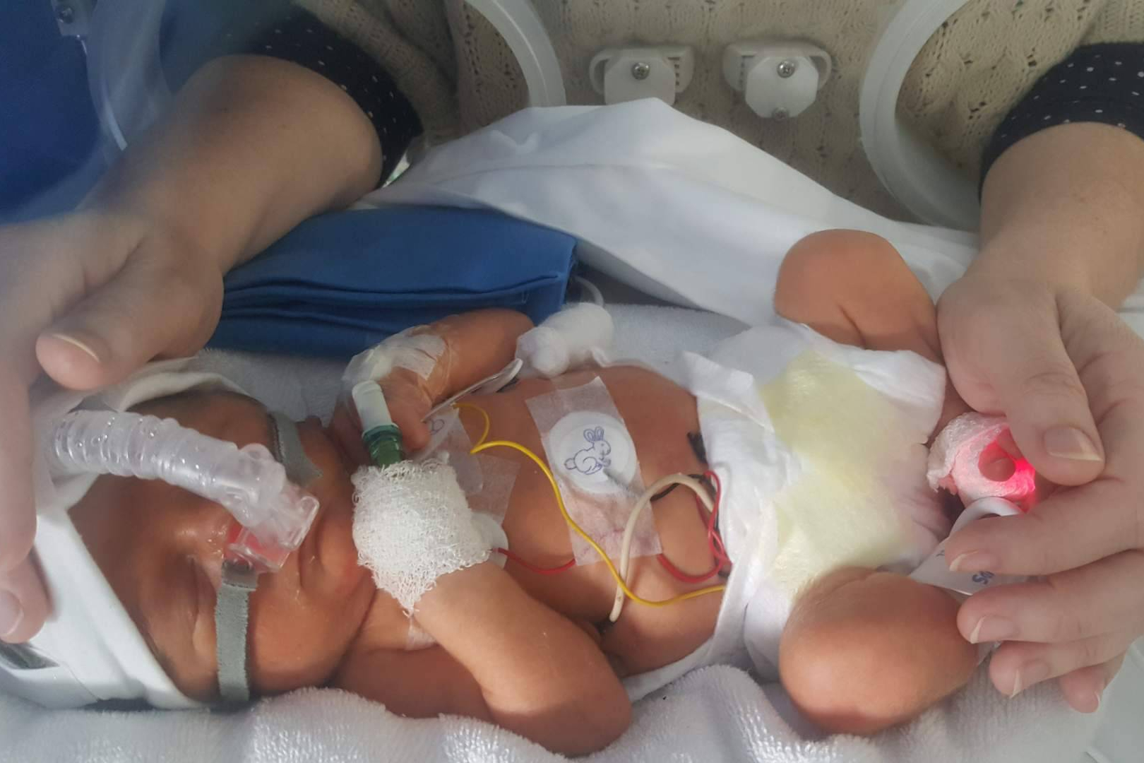 Cada bebé prematuro, una historia de lucha familiar en el Día Mundial de la Prematuridad