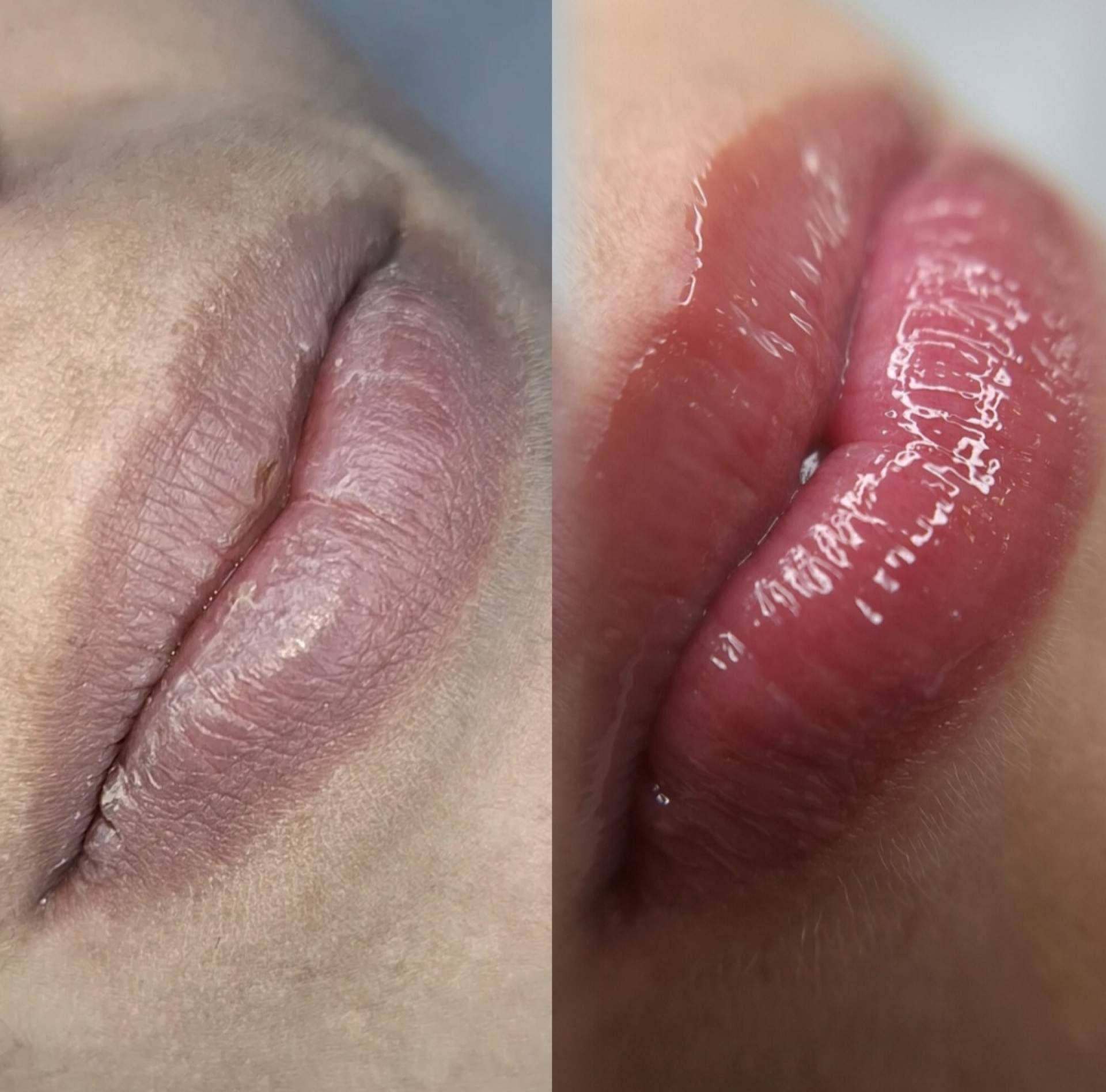 Belleza y tratamientos avanzados, la propuesta especializada de Estética Elena Santos